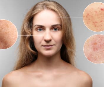 makijaz_korekcyjny_sztuka_sluzbie_dermatologii