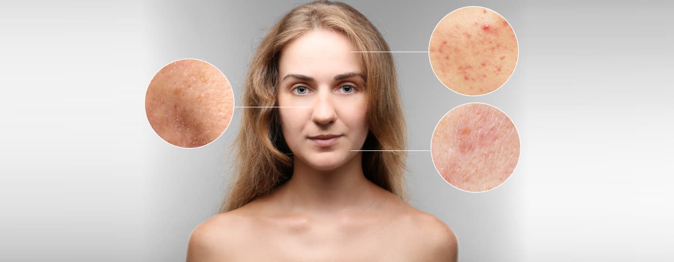 makijaz_korekcyjny_sztuka_sluzbie_dermatologii