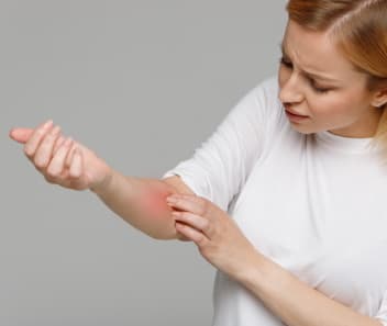 swedzace_zmiany_skorne_azs_alergia_kontaktowa